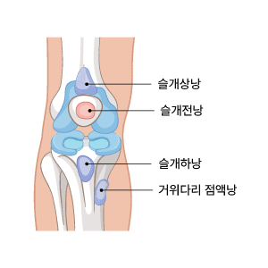 슬개골 불안정성